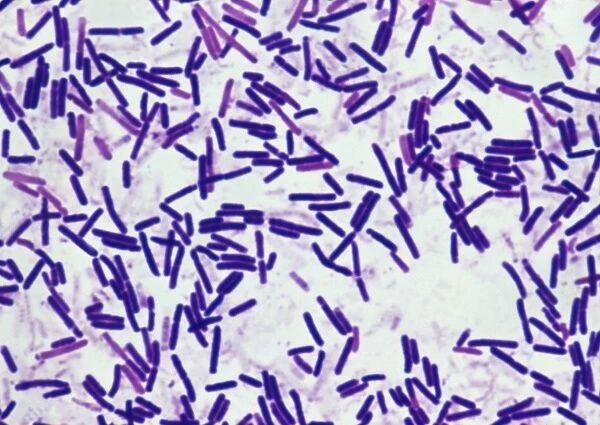 Botulism bacteria
