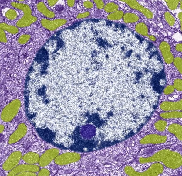 Cell nucleus, TEM