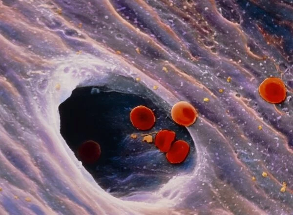 Coloured SEM of red blood cells in blood vessel