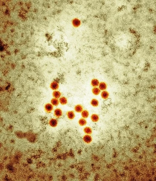 Coxsackie virus particles, TEM