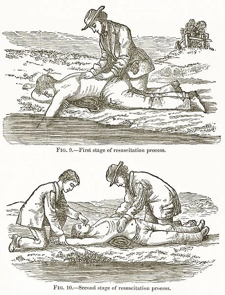 Emergency resuscitation, 19th century C015  /  6082