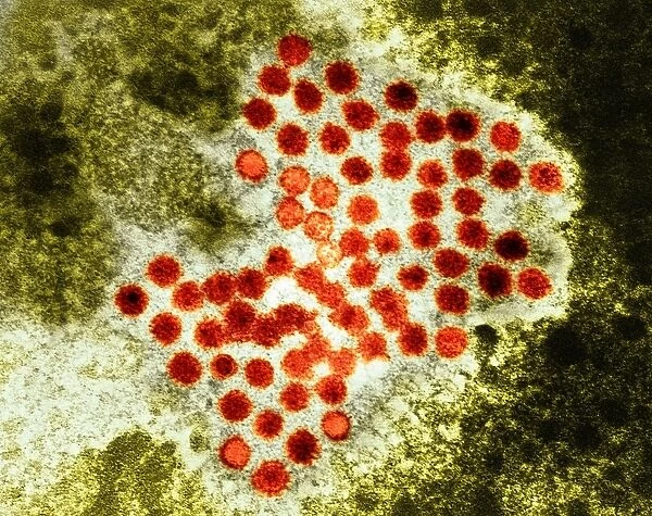 Hepatitis A virus particles, TEM