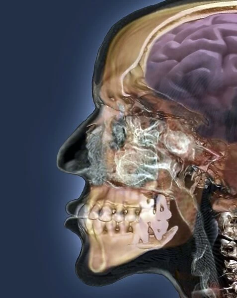 Human head, 3D CT scan C016  /  6377