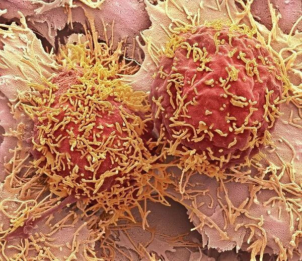 Liver cancer cells, SEM