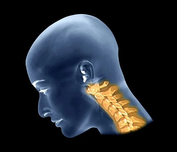 Normal flexed neck, X-ray C016  /  6426