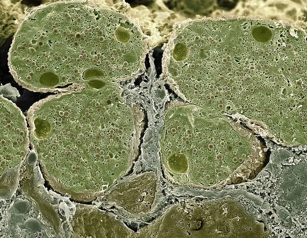Pancreas cells, SEM