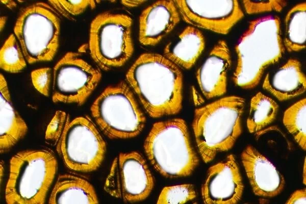Plasmodesma plant cells, light micrograph