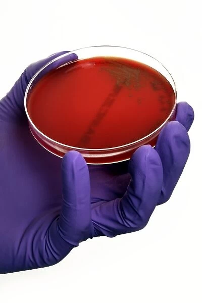 Pneumonia bacteria in a petri dish