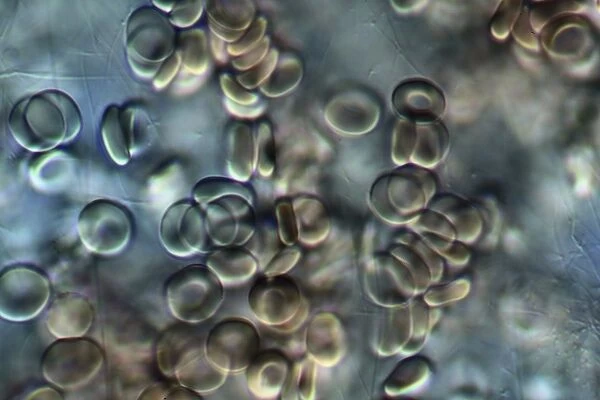 Red blood cells, light micrograph C016  /  3035