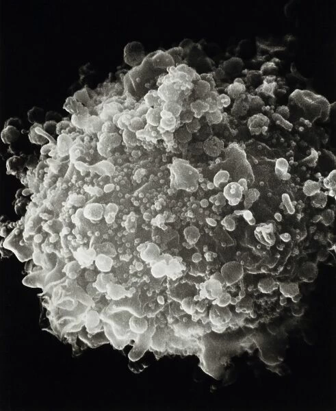 SEM of whole T-cell infected with HIV