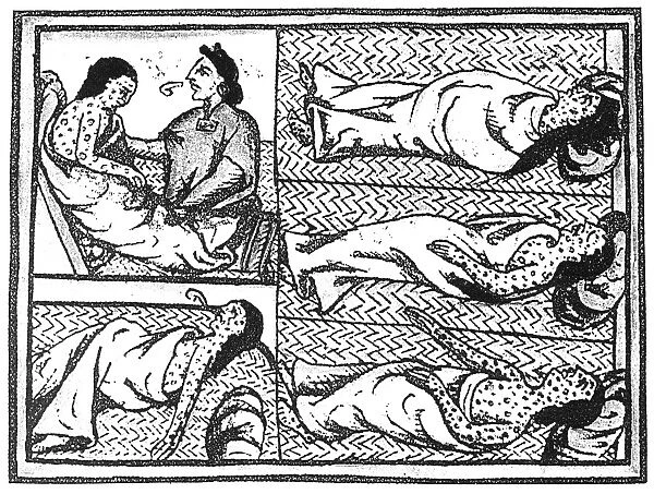 Aztec Native Americans with smallpox contracted from the Spanish conquistadors ministered to by a medicine man. Illustration from the Franciscan missionary Bernardino de Sahaguns 16th century treatise, General History of the Things of New Spain