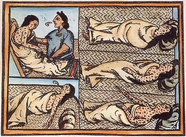 Aztec natives, with smallpox contracted from the Spaniards, ministered to by a medicine man. Illustration from Father Bernardino de Sahaguns 16th century treatise, General History of the Things of New Spain