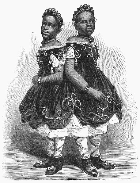 THE CAROLINA TWINS, 1866. Millie and Christine McKoy, American conjoined twins
