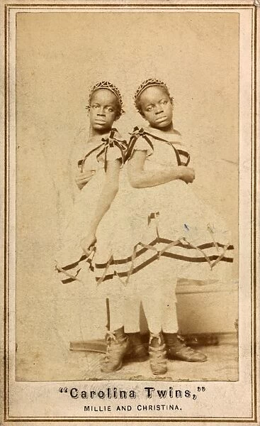 THE CAROLINA TWINS, c1866. Millie and Christine McKoy, American conjoined twins