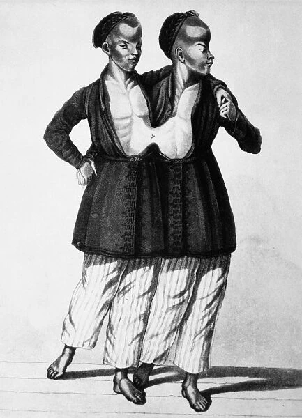 CHANG AND ENG (1811-1874). The original Siamese twins. Lithograph, 19th century