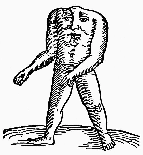 HEADLESS MAN, 1557. Woodcut from the Prodigiorum of Conrad Lycosthenes, 1557