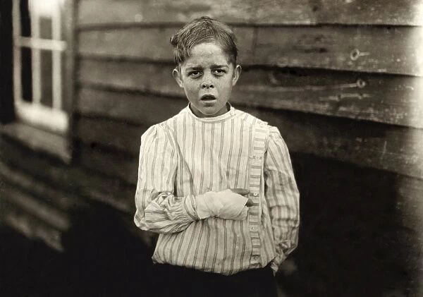 HINE: CHILD LABOR, 1912. A young cotton mill worker injured by a piece of machinery