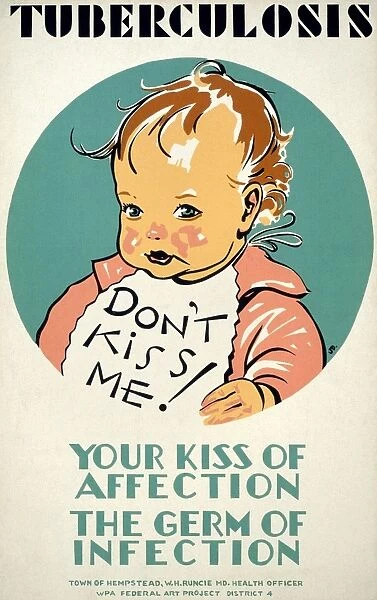 Your Kiss of Affection, the Germ of Infection. American poster about tuberculosis in children and methods of transmission. Poster ran from 1936 to 1939 for the Works Progress Adminstrations Federal Art Project
