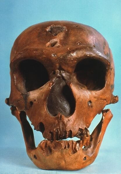 NEANDERTHAL SKULL. Frontal view of typical Neanderthal skull from La Chapelle-aux-Saints