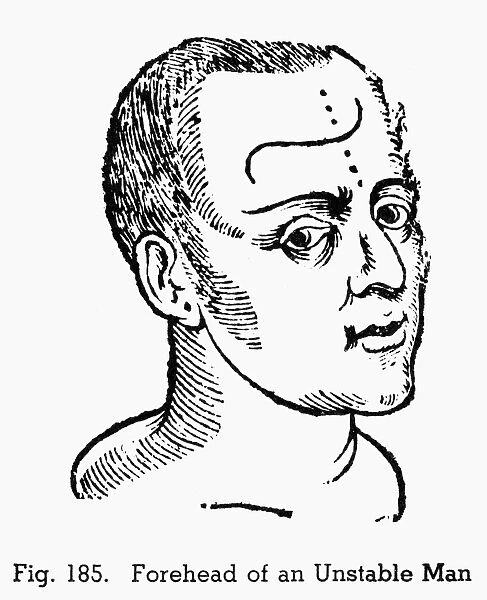 PHYSIOGNOMY, 1648. Forehead of an unstable man