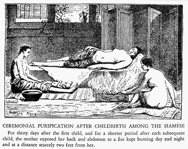 A Siamese ceremonial purification rite entailing a mother to expose her back and abdomen to a constantly burning fire roughly two feet away from her for 30 days after her first childs birth, and for a shorter period after each subsequent child. Wood engraving, 19th century
