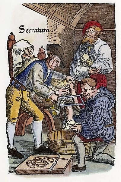 Surgeon performing an amputation. Woodcut from an edition of Hans von Gersdoffs Feldtbuch der Wundartzney, Strassburg, 1540