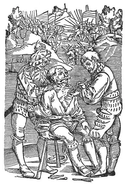 A surgeon removing an arrow from a wounded soldier. Woodcut from an edition of Hans von Gersdoffs Feldtbuch der Wundartzney (Guide to Surgery), Strassburg, Germany, 1540
