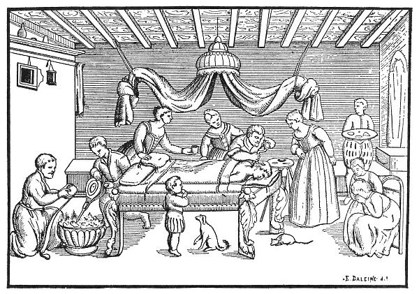 A surgeon trephining the skull of a patient at home. Line engraving after a 16th century woodcut
