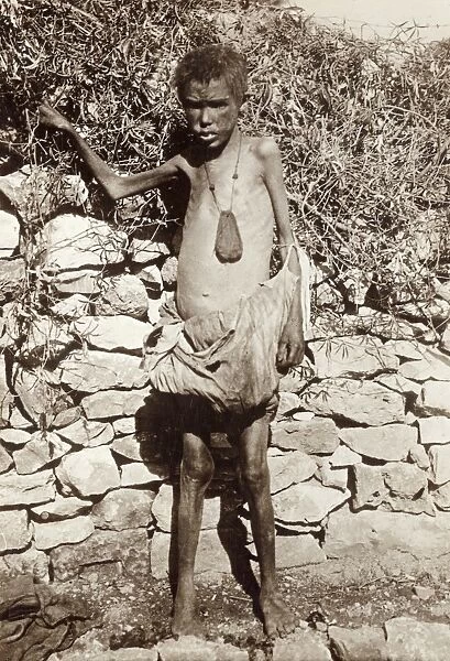 WWI: REFUGEES, 1919. A starving boy in northern Palestine, whose parents were both