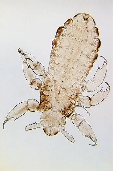 Head louse (Pediculus humanus capitis) under microscope