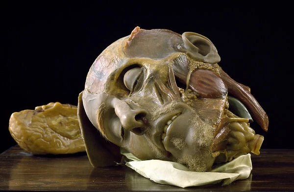 Anatomical model of an old mans head (wax)