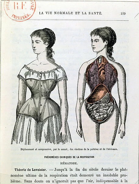 The Harmful Effects of the Corset, illustration from La Vie Normale et la Sante