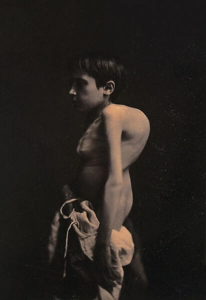 Portrait of a hunchback boy, c. 1855-57 (coated salt print)