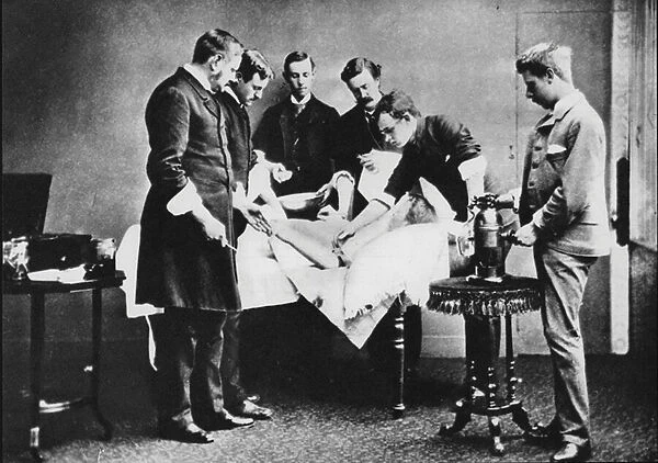 Use of Joseph Listers Carbolic Spray, operation, Royal Infirmary Aberdeen c 1882 (b  /  w photo)