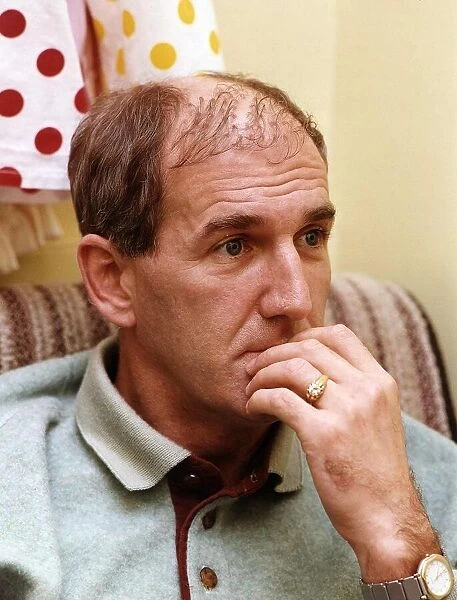 Russ Abbot in a theatre dressing room shows his Hair Transplant A©Mirrorpix