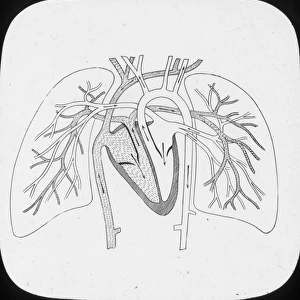 X-Ray - Pulmonary Circulation