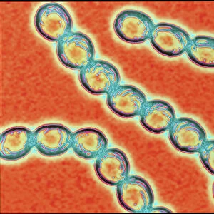 Chains of Streptococcus pyogenes bacteria