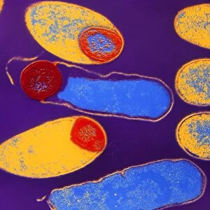 Clostridium botulinum bacteria with spores