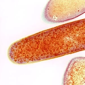 Clostridium difficile bacteria, TEM