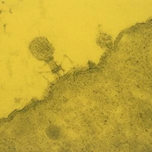 False-col TEM of T4 bacteriophage in E. coli