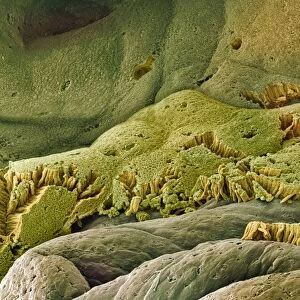 Gall bladder surface, SEM