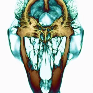 Gorilla skull, X-ray