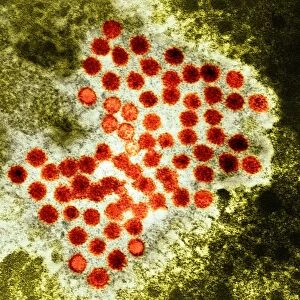 Hepatitis A virus particles, TEM