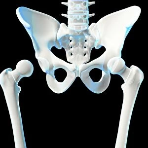 Hip joint bones and anatomy, artwork C014 / 2032