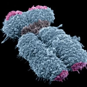 Human chromosome, SEM C013 / 4999