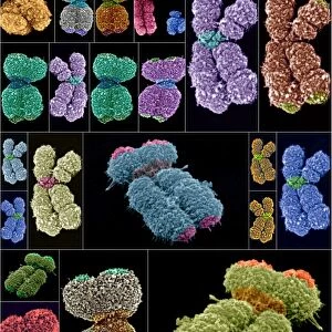 Human chromosomes, SEMs