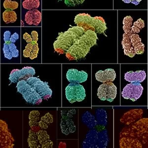 Human chromosomes, SEMs C013 / 4989