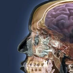 Human head, 3D CT scan C016 / 6377