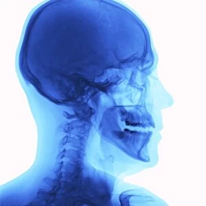 Human head, x-ray F007 / 1993