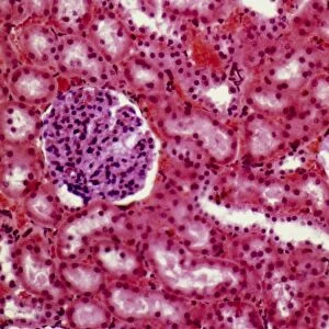 Kidney glomeruli, light micrograph